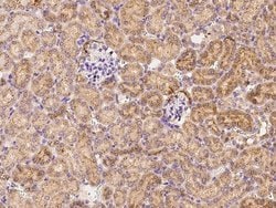 Invitrogen IL20RA Polyclonal Antibody 100 &mu;L; Unconjugated:Antibodies,