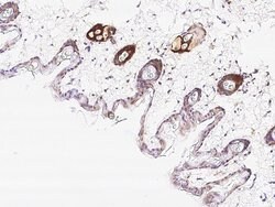 Invitrogen IL20RA Polyclonal Antibody 100 &mu;L; Unconjugated:Antibodies,