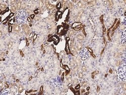 Invitrogen Kallikrein 1 Polyclonal Antibody 100 &mu;L; Unconjugated:Antibodies,