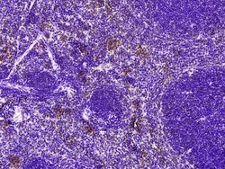 Invitrogen LAIR1 Polyclonal Antibody 100 &mu;L; Unconjugated:Antibodies,