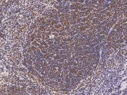 Invitrogen LILRB4 Polyclonal Antibody 100 &mu;L; Unconjugated:Antibodies,