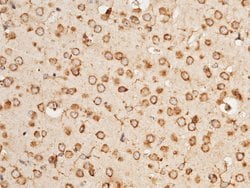 Invitrogen RAP Polyclonal Antibody 100 &mu;L; Unconjugated:Antibodies,