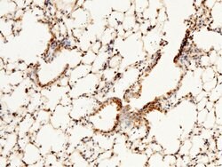Invitrogen RAP Polyclonal Antibody 100 &mu;L; Unconjugated:Antibodies,