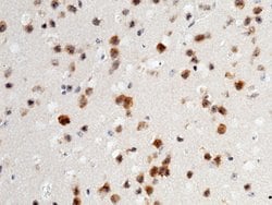 Invitrogen NAALADL1 Polyclonal Antibody 100 &mu;L | Buy Online | Invitrogen&trade; | Fisher Scientific