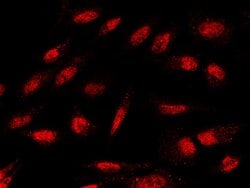 Invitrogen IkB beta Polyclonal Antibody 100 &mu;L; Unconjugated:Antibodies,