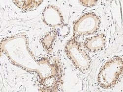 Invitrogen IkB beta Polyclonal Antibody 100 &mu;L; Unconjugated:Antibodies,