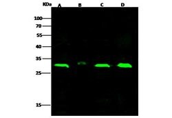 Invitrogen IkB beta Polyclonal Antibody 100 &mu;L; Unconjugated:Antibodies,