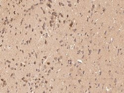 Invitrogen PCSK9 Polyclonal Antibody 100 &mu;L; Unconjugated:Antibodies,