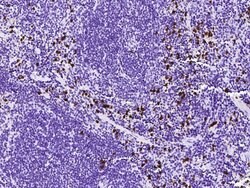 Invitrogen S100A8 Polyclonal Antibody 100 &mu;L; Unconjugated:Antibodies,