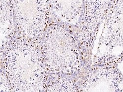 Invitrogen SALL4 Polyclonal Antibody 100 &mu;L; Unconjugated:Antibodies,