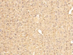 Invitrogen SERPINA7 Polyclonal Antibody 100 &mu;L; Unconjugated:Antibodies,