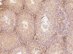 Invitrogen SLC27A3 Polyclonal Antibody 100 &mu;L; Unconjugated:Antibodies,