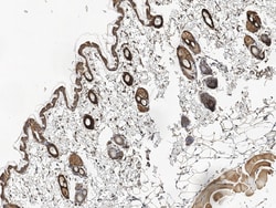 Invitrogen TROP2 Polyclonal Antibody 100 &mu;L; Unconjugated:Antibodies,
