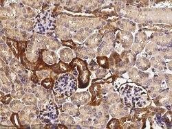 Invitrogen TROP2 Polyclonal Antibody 100 &mu;L; Unconjugated:Antibodies,