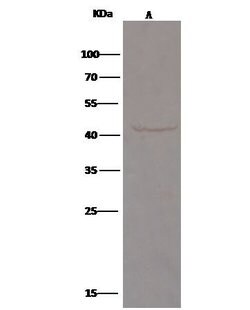 Invitrogen TNFR2 Polyclonal Antibody 100 &mu;L | Buy Online | Invitrogen&trade; | Fisher Scientific