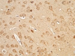 Invitrogen UCHL3 Polyclonal Antibody 100 &mu;L; Unconjugated:Antibodies,