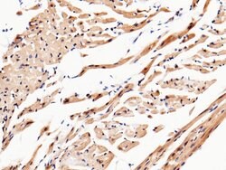 Invitrogen UCHL3 Polyclonal Antibody 100 &mu;L; Unconjugated:Antibodies,