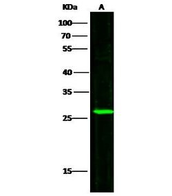 Invitrogen UCHL3 Polyclonal Antibody 100 &mu;L; Unconjugated:Antibodies,