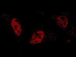 Invitrogen ARIH2 Polyclonal Antibody 100 &mu;L | Buy Online | Invitrogen&trade; | Fisher Scientific