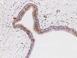 Invitrogen ARIH2 Polyclonal Antibody 100 &mu;L | Buy Online | Invitrogen&trade; | Fisher Scientific
