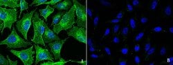 FXR1 Polyclonal Antibody:Antibodies, Polyclonal