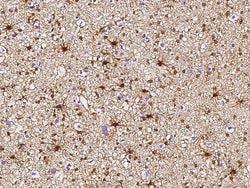 Glutamine Synthetase Polyclonal Antibody:Antibodies, Polyclonal