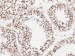 HDAC1 Polyclonal Antibody:Antibodies, Polyclonal