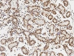 Invitrogen JMJD5 Polyclonal Antibody 100 &mu;L; Unconjugated:Antibodies,