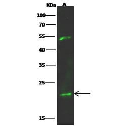 Invitrogen K-Ras Polyclonal Antibody 100 &mu;L | Buy Online | Invitrogen&trade; | Fisher Scientific