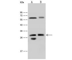 Invitrogen LIN7A Polyclonal Antibody 100 &mu;L; Unconjugated:Antibodies,