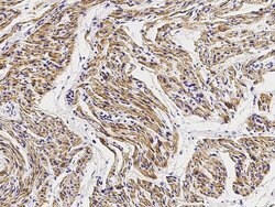 Invitrogen MEK6 Polyclonal Antibody 100 &mu;L; Unconjugated:Antibodies,