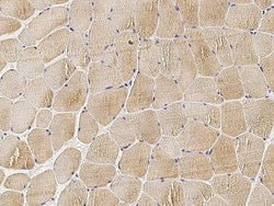 Invitrogen MEK6 Polyclonal Antibody 100 &mu;L; Unconjugated:Antibodies,
