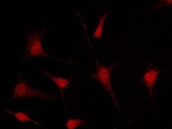 Invitrogen MSI1 Polyclonal Antibody 100 &mu;L; Unconjugated:Antibodies,
