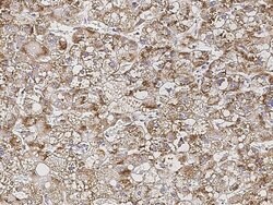 Invitrogen MSI1 Polyclonal Antibody 100 &mu;L; Unconjugated:Antibodies,