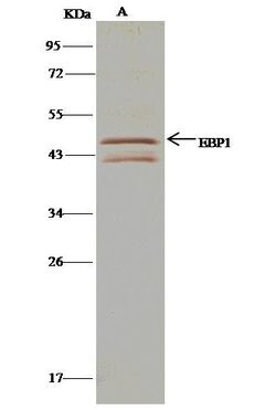 Invitrogen MYOD Polyclonal Antibody 100 &mu;L; Unconjugated:Antibodies,