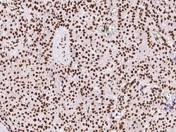 Invitrogen RbAp48 Polyclonal Antibody 100 &mu;L; Unconjugated:Antibodies,