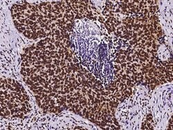 Invitrogen RbAp48 Polyclonal Antibody 100 &mu;L; Unconjugated:Antibodies,