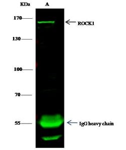 Invitrogen ROCK1 Polyclonal Antibody 100 &mu;L; Unconjugated:Antibodies,