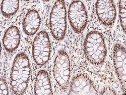 Invitrogen ECD Polyclonal Antibody 100 &mu;L; Unconjugated:Antibodies,