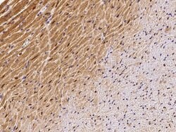 Invitrogen ECD Polyclonal Antibody 100 &mu;L; Unconjugated:Antibodies,