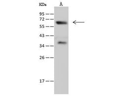 Invitrogen Synaptotagmin 1 Polyclonal Antibody 100 &mu;L | Buy Online | Invitrogen&trade; | Fisher Scientific