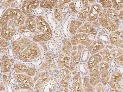 Invitrogen ACE Polyclonal Antibody 100 &mu;L; Unconjugated:Antibodies,
