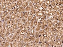 Invitrogen Profilin 1 Polyclonal Antibody 100 &mu;L; Unconjugated:Antibodies,