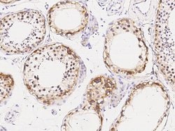 Invitrogen CD30 Polyclonal Antibody 100 &mu;L; Unconjugated:Antibodies,