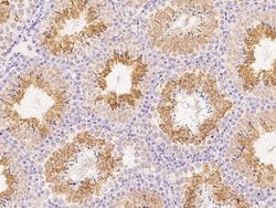 Invitrogen ANGEL1 Polyclonal Antibody 100 &mu;L; Unconjugated:Antibodies,