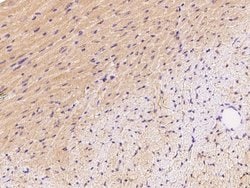 Invitrogen FNDC5 Polyclonal Antibody 100 &mu;L; Unconjugated:Antibodies,