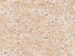 Invitrogen FNDC5 Polyclonal Antibody 100 &mu;L; Unconjugated:Antibodies,