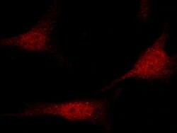 PRMT1 Polyclonal Antibody:Antibodies, Polyclonal