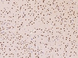 PRMT1 Polyclonal Antibody:Antibodies, Polyclonal