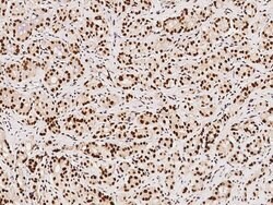 PRMT1 Polyclonal Antibody:Antibodies, Polyclonal